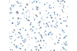 Immunocytochemistry (ICC) image for anti-Poly (ADP-Ribose) Polymerase 1 (PARP1) (AA 750-800) antibody (ABIN7449457)