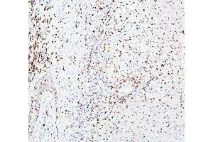 IHC analysis of CRB1 using anti-CRB1 antibody (ABIN6719658). (CRB1 anticorps)
