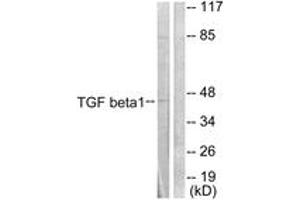 Western blot analysis of extracts from HepG2 cells, using TGF beta1 Antibody. (TGFB1 anticorps  (AA 336-385))