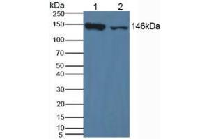 Western blot analysis of (1) Mouse Liver Tissue and (2) Mouse Lung Tissue.