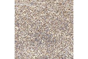 IHC analysis of SNRNP27 using anti-SNRNP27 antibody (ABIN7599614). (SNRNP27 anticorps  (AA 100-155))