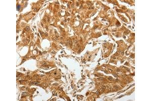 Immunohistochemistry (IHC) image for anti-Transforming Growth Factor, beta Receptor 1 (TGFBR1) antibody (ABIN2426967) (TGFBR1 anticorps)