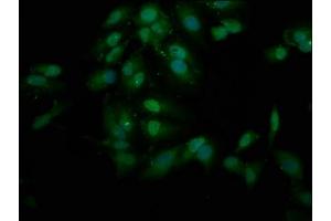 Immunofluorescence staining of Hela cells with ABIN7151021 at 1:200, counter-stained with DAPI.