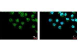ICC/IF Image LIMD1 antibody [C2C3], C-term detects LIMD1 protein at cytoplasm and nucleus by immunofluorescent analysis. (LIMD1 anticorps  (C-Term))