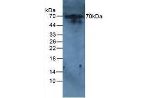 Detection of IL6R in Rat Liver Tissue using Polyclonal Antibody to Interleukin 6 Receptor (IL6R) (IL-6 Receptor anticorps  (AA 385-462))