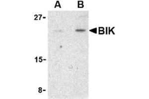 Image no. 1 for anti-BCL2-Interacting Killer (Apoptosis-Inducing) (BIK) (N-Term) antibody (ABIN318742) (BIK anticorps  (N-Term))