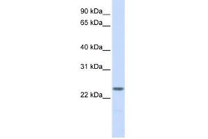 WB Suggested Anti-NPM2 Antibody Titration: 0. (NPM2 anticorps  (N-Term))