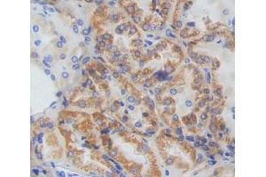 IHC-P analysis of kidney tissue, with DAB staining. (CISH anticorps  (AA 1-258))