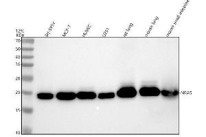 Western blot analysis of NRAS using anti-NRAS antibody (ABIN7606144).
