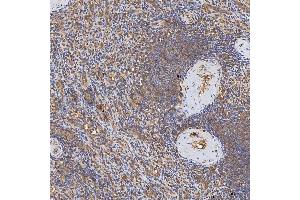 IHC analysis of Syntenin 2/SDCBP2 using anti-Syntenin 2/SDCBP2 antibody (ABIN7600017).