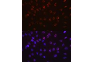 Immunofluorescence analysis of C6 cells using Aurora B antibody (ABIN7265782). (Aurora Kinase B anticorps)
