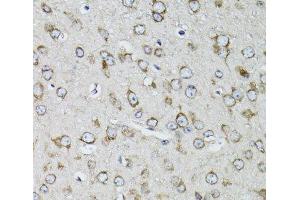 Immunohistochemistry of paraffin-embedded Mouse brain using RPS10 Polyclonal Antibody at dilution of 1:100 (40x lens).