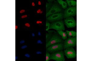 ABIN6264808 and ABIN6276442 staining  cells by IF/ICC. (RPA1 anticorps  (Internal Region))