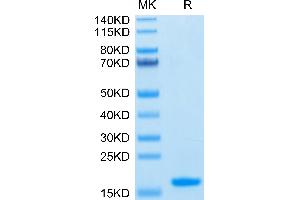 Human Nectin-4 IgV Domain on Tris-Bis PAGE under reduced condition.