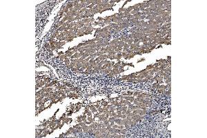 IHC analysis of Astrin/Deepest/SPAG5 using anti-Astrin/Deepest/SPAG5 antibody (ABIN7602399).