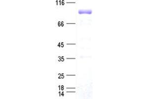 Validation with Western Blot