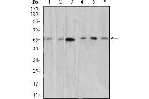Western blot analysis using AKT1 mouse mAb against A549 (1), MCF-7 (2), Hela (3), COS7 (4), C6 (5), and HL-60 (6) cell lysate.