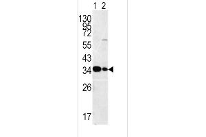Western blot analysis of ST antibody (C-term) (ABIN392001 and ABIN2841786) in HepG2ane 1nd Hela(lane2 ) cell line lysates (35 μg/lane). (MPST anticorps  (C-Term))