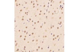 Immunohistochemistry of paraffin embedded rat brain using ALS2CR13 (ABIN7073909) at dilution of 1:1800 (400x lens) (FAM117B anticorps)