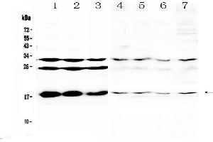 Western blot analysis of TSLP using anti-TSLP antibody . (Thymic Stromal Lymphopoietin anticorps)