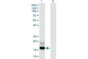 Western Blot analysis of PFDN4 expression in transfected 293T cell line by PFDN4 monoclonal antibody (M03), clone 2G4. (PFDN4 anticorps  (AA 1-134))