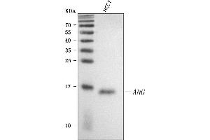 Western blot analysis of Angiogenin/ANG using anti-Angiogenin/ANG antibody (ABIN4886457). (ANG anticorps  (AA 25-147))