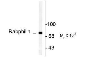 Image no. 1 for anti-Rabphilin 3A (RPH3A) (pSer234) antibody (ABIN372710)