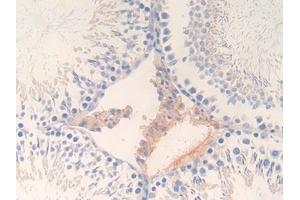 Detection of GAD2 in Rat Testis Tissue using Polyclonal Antibody to Glutamate Decarboxylase 2 (GAD2)