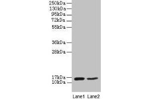 Western blot All lanes: CD59 antibody at 2 μg/mL Lane 1: Mouse heart tissue Lane 2: NIH/3T3 whole cell lysate Secondary Goat polyclonal to rabbit IgG at 1/10000 dilution Predicted band size: 15 kDa Observed band size: 15 kDa (CD59 anticorps  (AA 26-102))