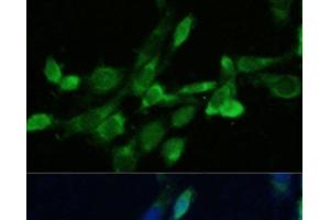 Immunofluorescence analysis of NIH-3T3 cells using FDFT1 Polyclonal Antibody at dilution of 1:100.