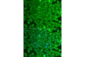 Immunofluorescence analysis of A549 cells using KBTBD7 antibody (ABIN5975133). (KBTBD7 anticorps)