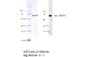 Western Blotting (WB) image for gamma Glutamyltransferase 1 (GGT1) (AA 27-569) protein (His tag) (ABIN3113071) (GGT1 Protein (AA 27-569) (His tag))