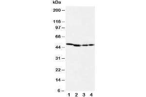Western blot testing of MEK1 antibody and Lane 1:  rat skeletal muscle;  2: rat kidney;  3: (h) CEM;  4: (h) COLO20 cell lysate (MEK1 anticorps  (C-Term))