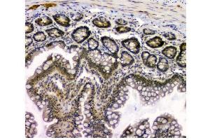 IHC analysis of STUB1 using anti STUB1 antibody (ABIN6719414).