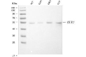 Western blot analysis of LOX 1/OLR1 using anti-LOX 1/OLR1 antibody (ABIN3044199).