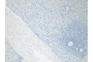 (ABIN334402) Negative Control showing staining of paraffin embedded Human Spleen, with no primary antibody.