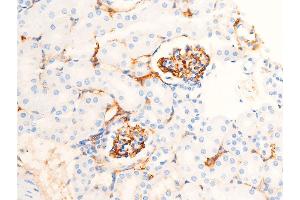 ABIN6267222 at 1/100 staining mouse kidney tissue sections by IHC-P.