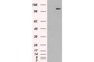 HEK293T cells were transfected with the pCMV6-ENTRY control (Left lane) or pCMV6-ENTRY L1CAM (Right lane) cDNA for 48 hrs and lysed. (L1CAM anticorps)