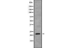 Western blot analysis SAR1A using HeLa whole cell lysates (SAR1A anticorps  (Internal Region))