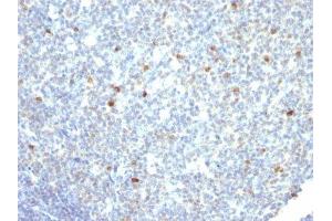 Image no. 2 for Mouse anti-Human IgM antibody (ABIN6155086)