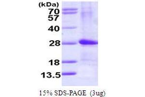 SDS-PAGE (SDS) image for ADP-Ribosylation Factor-Like 4D (ARL4D) (AA 1-201) protein (His tag) (ABIN667588)