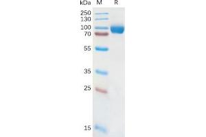 Human IL18RA Protein, hFc Tag on SDS-PAGE under reducing condition.