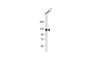 Anti-ROR1 Antibody at 1:4000 dilution + NC-1 whole cell lysate Lysates/proteins at 20 μg per lane. (ROR1 anticorps)