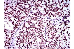 Immunohistochemistry (IHC) image for anti-Ring Finger Protein 1 (RING1) (AA 79-263) antibody (ABIN1845880) (RING1 anticorps  (AA 79-263))