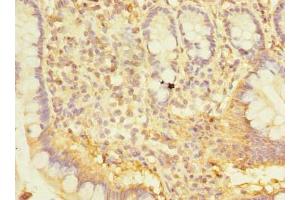 Immunohistochemistry of paraffin-embedded human small intestine tissue using ABIN7170402 at dilution of 1:100 (SNX6 anticorps  (AA 1-290))