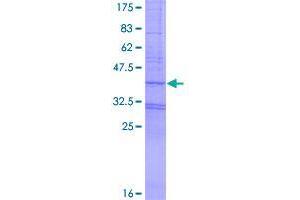 Image no. 1 for Fat Mass and Obesity-Associated (FTO) (AA 1-139) protein (GST tag) (ABIN1354483)