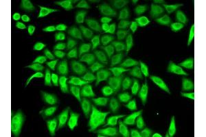 Immunofluorescence analysis of A549 cells using APRT antibody. (APRT anticorps  (AA 1-180))