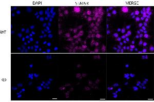 Immunocytochemical staining of Hela cells using STAT5B antibody (ABIN7800348), 1:1,000), Top panel: wild-type (WT), Bottom panal: STAT5B shRNA knockdown (KD). (Recombinant STAT5B anticorps)