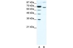 WB Suggested Anti-RACGAP1 Antibody Titration:  1. (RACGAP1 anticorps  (N-Term))