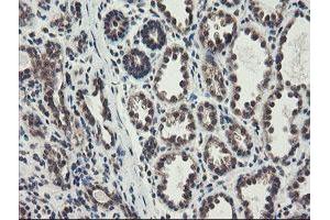 Immunohistochemical staining of paraffin-embedded Human breast tissue using anti-ACBD3 mouse monoclonal antibody. (ACBD3 anticorps)